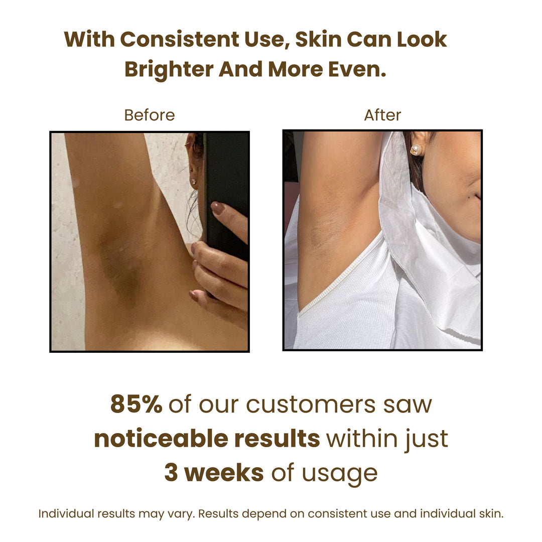 Natural Underarm Gel-50GM | Helps Brightens Dark Underarms & Control Odour • For Men & Women