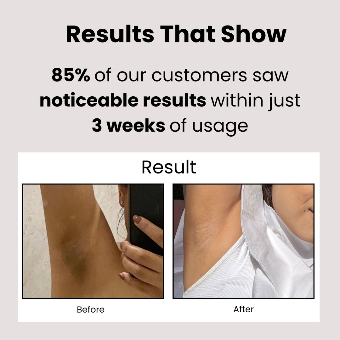 Natural Underarm Gel